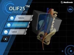 how-medtronic-uses-ipad-games-to-train-surgeons