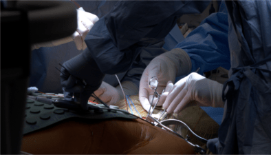Surgical Procedure Video